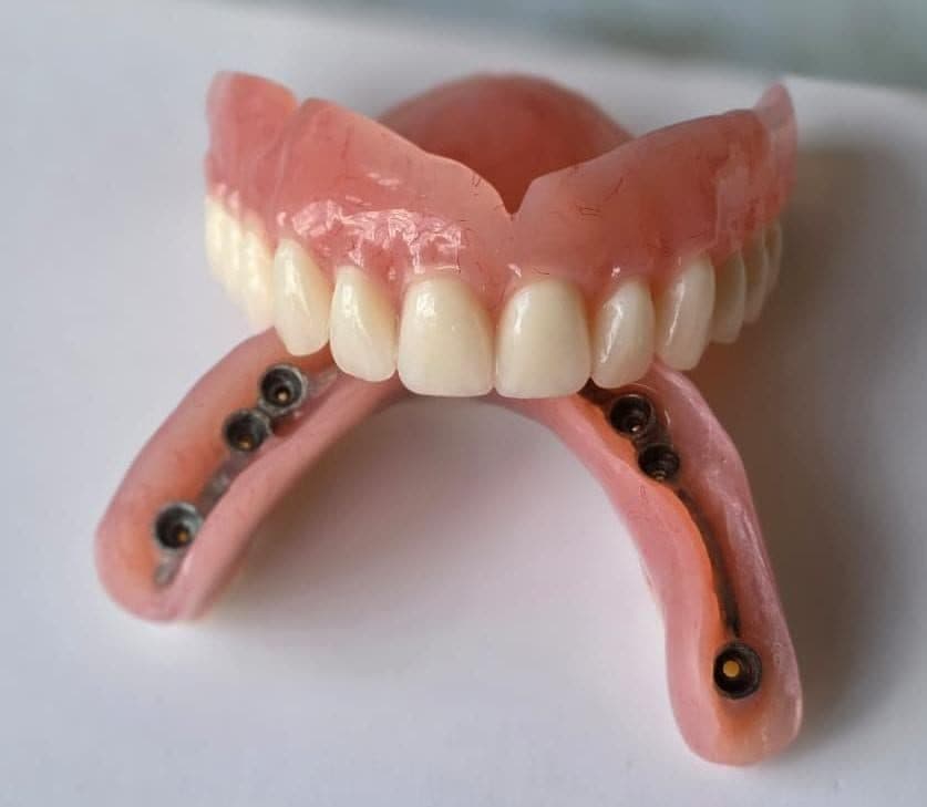Prótesis dentales Removibles